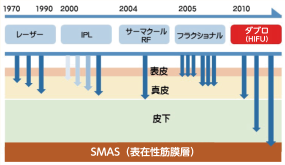 SMAS（表在性筋膜層）